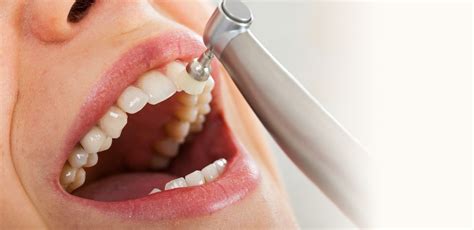 Advanced Tips for Professional Teeth Cleaning Secrets Unveiled