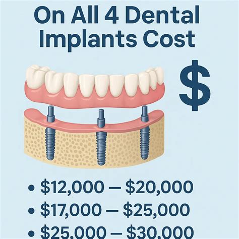Discover Affordable All-on-4 Dental Implants Cost in Canada