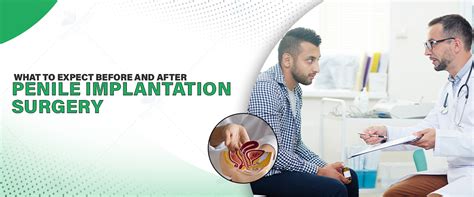 Before After Penile Surgery