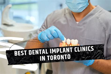 Top Best Dental Clinic in Toronto Revealed