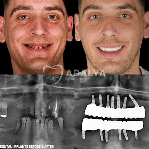 Best Dental Clinic Before-After Transformations Revealed