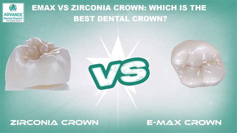 Best Dental Crown Cost in Canada Uncovered