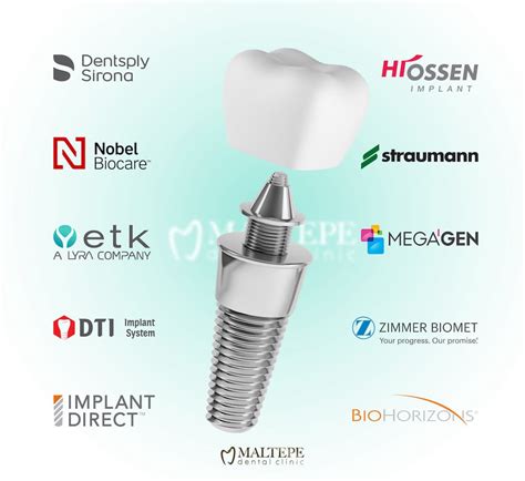 Top Rated Best Dental Implants in Singapore