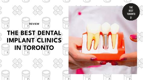 Top Rated Best Dental Surgery in Toronto