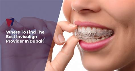 Best Invisalign Treatment in Dubai Uncovered Top Secret