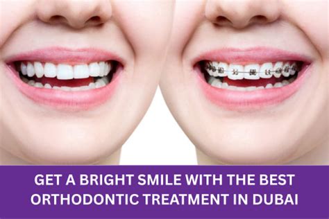 Top-Rated Best Orthodontic Treatment in Dubai 2023