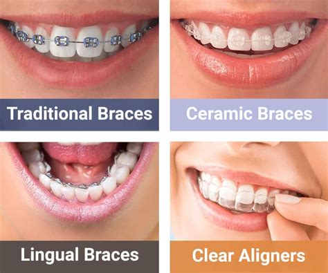 Top-Rated Best Orthodontic Treatment in USA Revealed