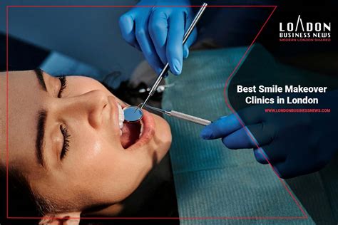 Top Smile Makeover Choices in London