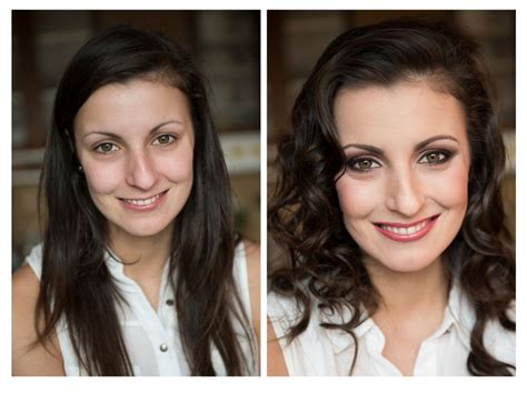 Top Smile Makeover in NYC: Expert Secrets Revealed