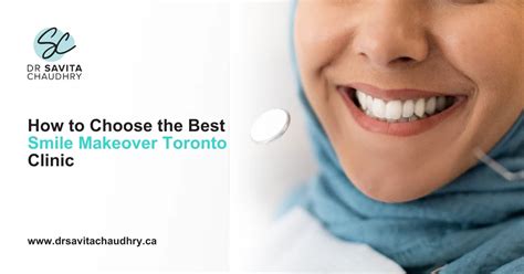 Top Smile Makeover in Toronto Revealed!