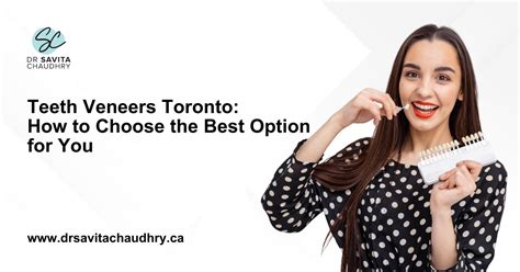 Top-Rated Veneers for Flawless Smiles in Toronto