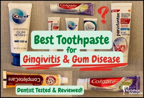 Top Strategies for Effective Gum Disease Management