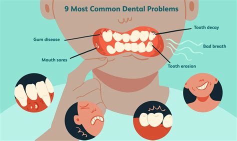 Spotting Common Dental Health Issues Early