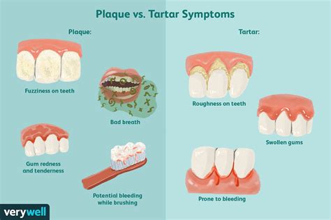 Common Problems with Plaque Removal: Expert Tips for Success