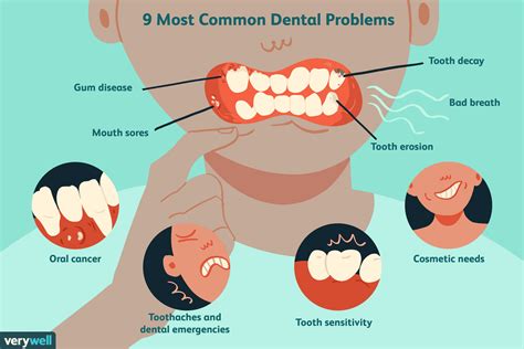 Uncovering Common Problems with Tooth Decay: What You Need to Know Now