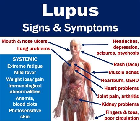 The Complete List Of Lupus Symptoms