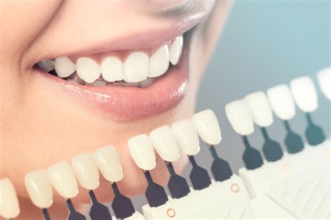 Cosmetic Dentistry Cost in Dubai: Secrets Revealed!