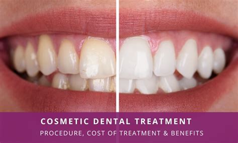 Uncovering the True Cost of Cosmetic Dentistry Treatment
