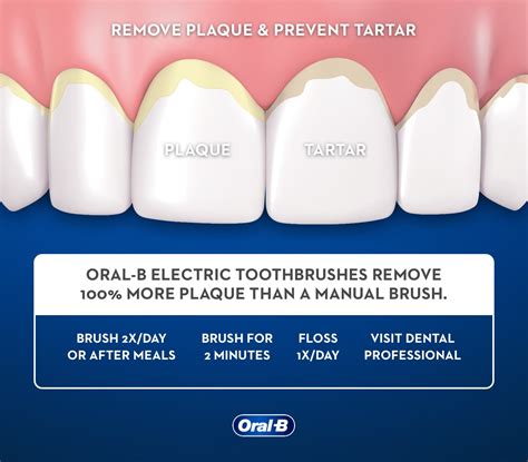Daily Habits for Plaque Removal That Dentists Recommend
