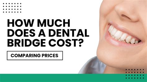 Dental Bridge Treatment Cost in Australia Revealed