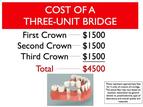 Unveiling Dental Bridge Treatment Cost in Canada: What You Need to Know