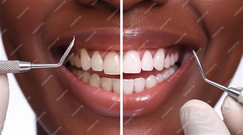Transformative Dental Checkup Before and After Results Revealed