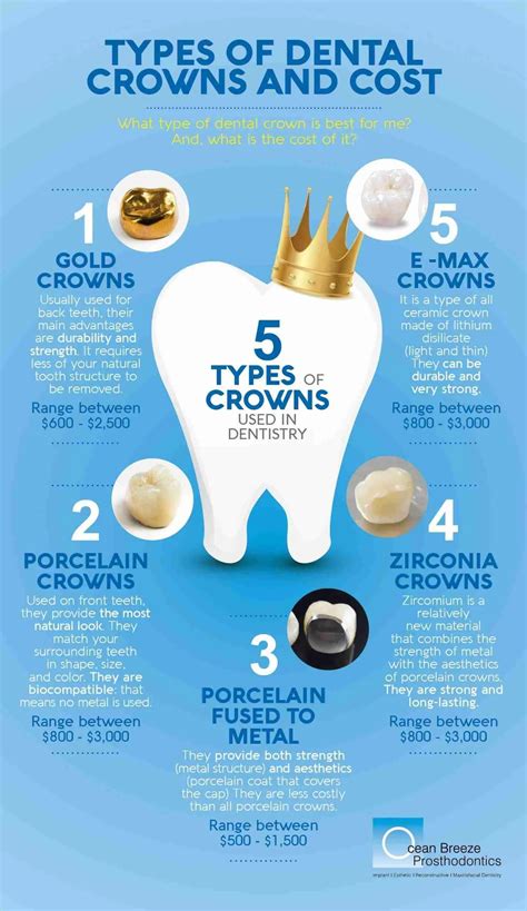 Dental Crown Cost Guide: Uncover True Costs!