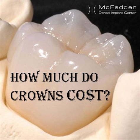 Understanding Dental Crown Cost Recovery Time: What to Expect