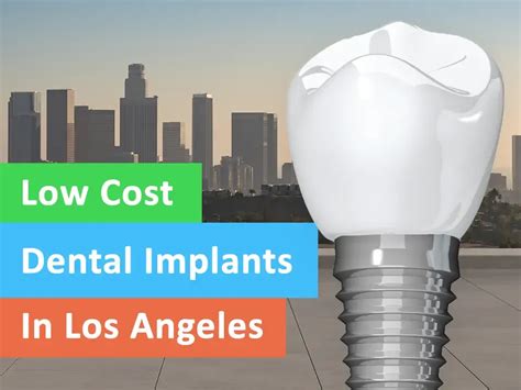 Dental Implants Cost Secrets in Los Angeles Uncovered!