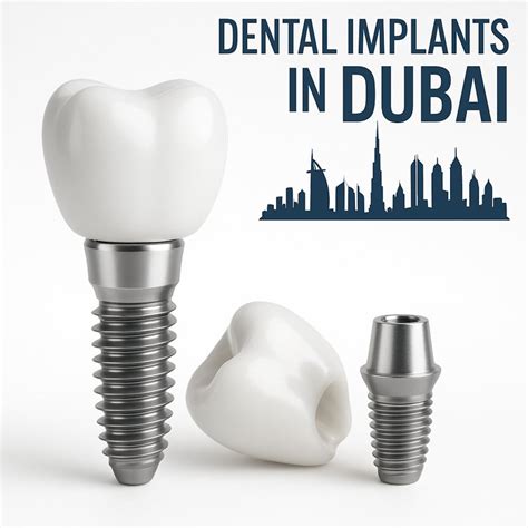 Top Dental Implants Dubai Services: Your Ultimate Guide to Perfect Smiles