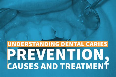 Dental Treatment Prevention Secrets Revealed!