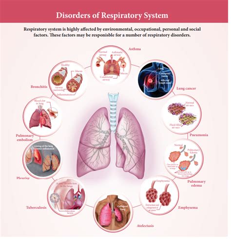 Understanding Respiratory Disorders Of The Respiratory System For Class 11 Students