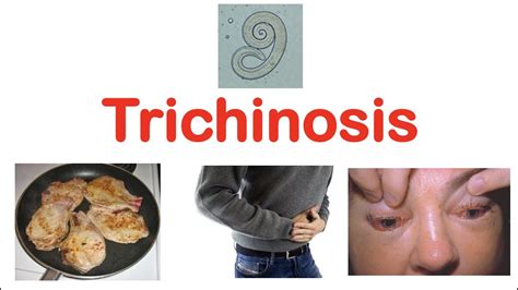 Does Freezing Kill Trichinosis In Pork Getting It Done Right