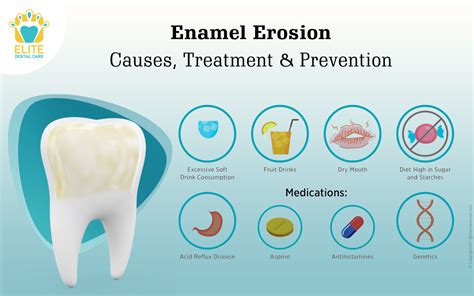 Enamel Care Prevention: Secrets to a Healthier Smile