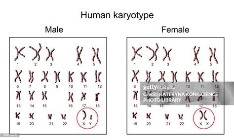 Decoding The Female Vs Male Karyotype: What The 46 Chromosomes Say About You