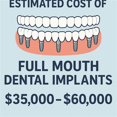 Full Mouth Dental Implants Cost Insight in Dubai