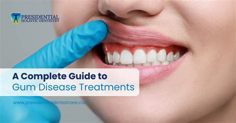 Complete Guide to Effective Gum Disease Treatment: Your Ultimate Solution Starts Here
