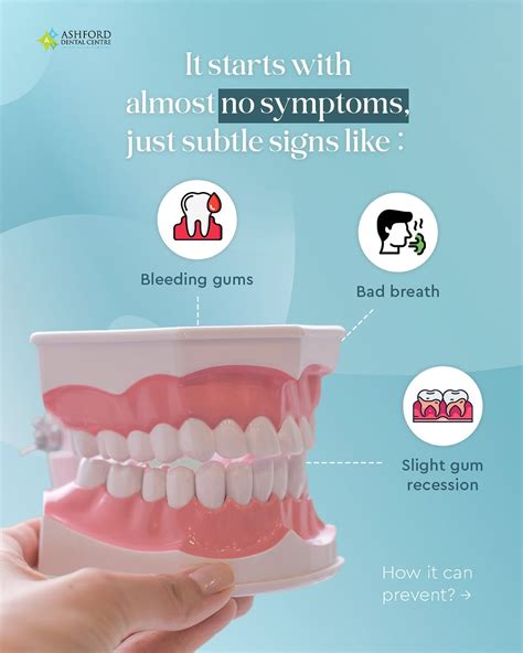 Top Gum Disease Treatment Singapore Secrets Revealed