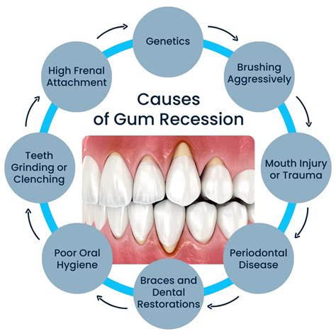 Top Secrets Behind Gum Health Causes