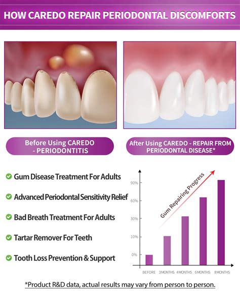 Best Gum Health Treatment Secrets Revealed