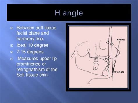 Why H Line Ortho Might Be Exactly What Your Spine Needs