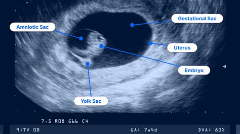 How Deep Can Ultrasound See And What That Means For Diagnosis