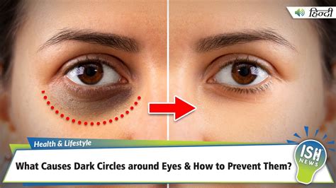 Why Your Eyes Appear Darker Over Time And How It Happens