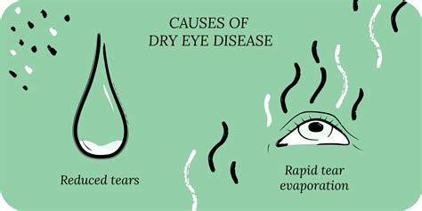Why Do Your Eyes Feel Heavy And Gritty At The End Of The Day