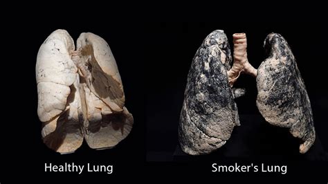 What Does Cigarette Smoke Do To Your Lungs: The Truth Revealed