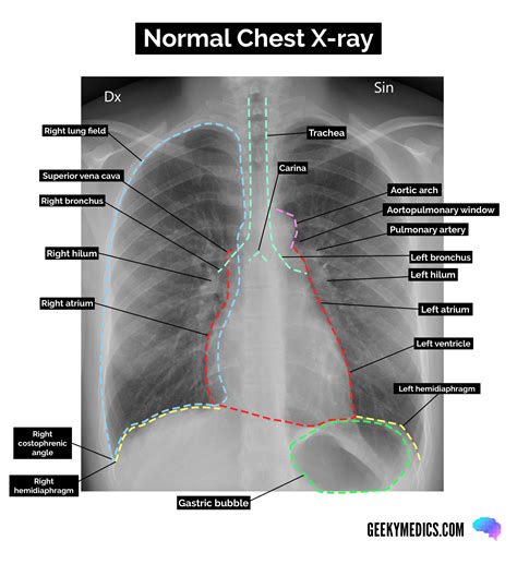 How Do You Xray Lungs Like A Professional | Stepbystep Guide
