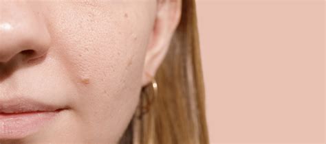 How To Control Oil On Face Without Stripping It Dry