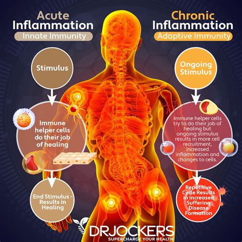 In The Body: What Is Inflammation And Why It Matters