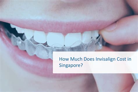 Get Perfect Smiles: Invisalign Treatment Singapore