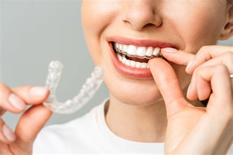 Invisible Braces Cost in Singapore: Surprising Facts!